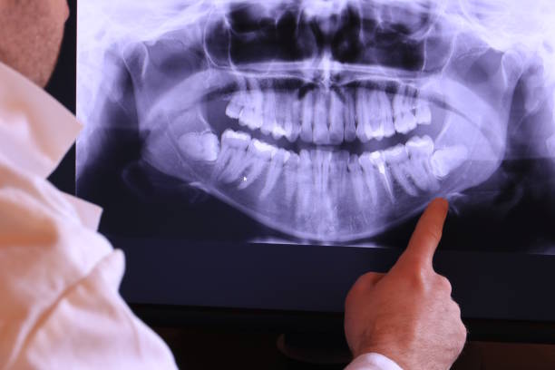 Best Weekend Emergency Dentist in Pine Hills, CA